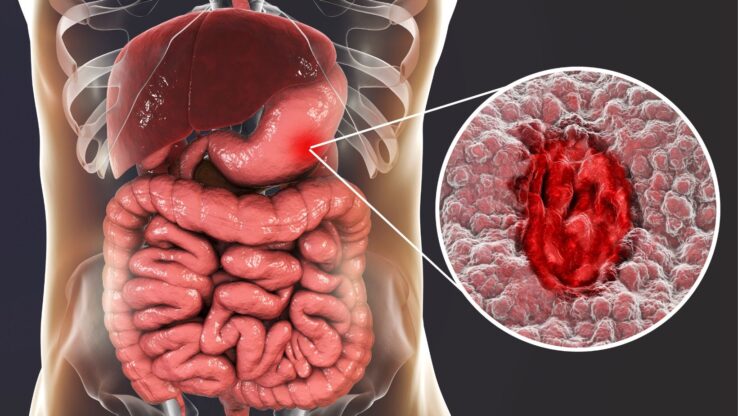 if gastric distention begins to make positive
