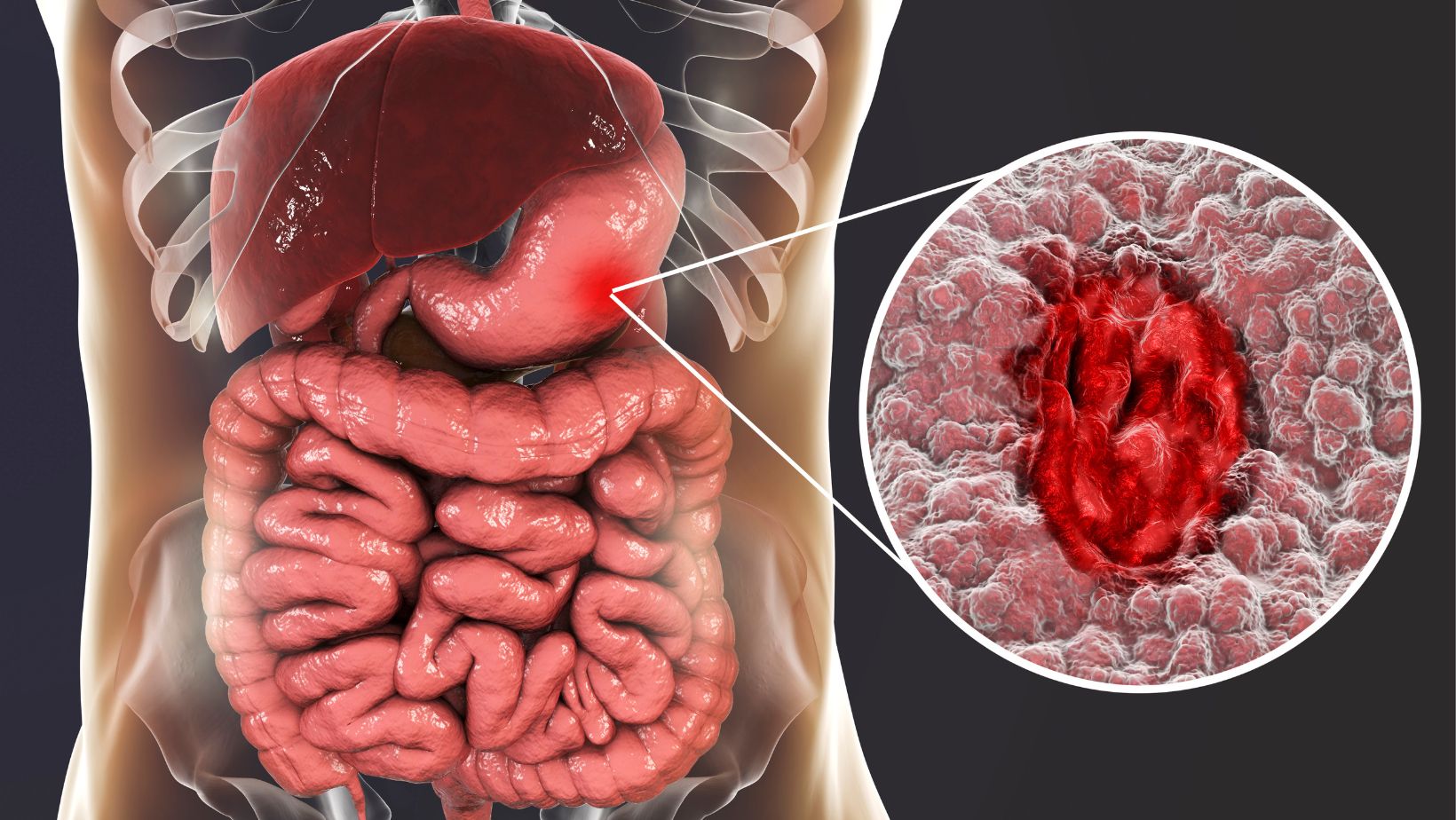 If gastric distention begins to make positive what are the symptoms of gastric distention